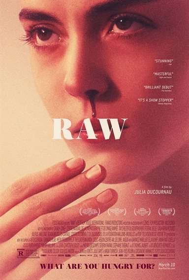 Raw © Focus World. All Rights Reserved. Raw © Focus World. All Rights Reserved.